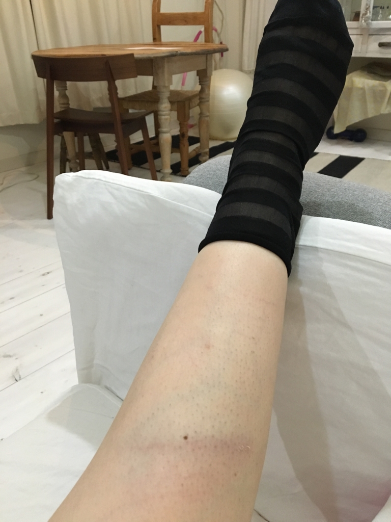 f:id:yoko807:20160620233534j:plain f:id:yoko807:20160620233534j:plain